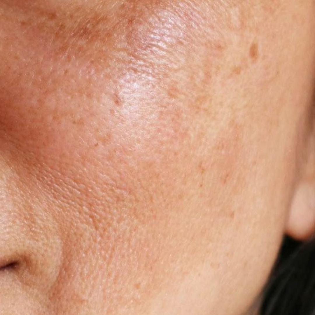 Pack Multi Marcha Anti Manchas Skinceuticals Phlorentin + Balance Cleansing Gel + Collection advanced Brightening
