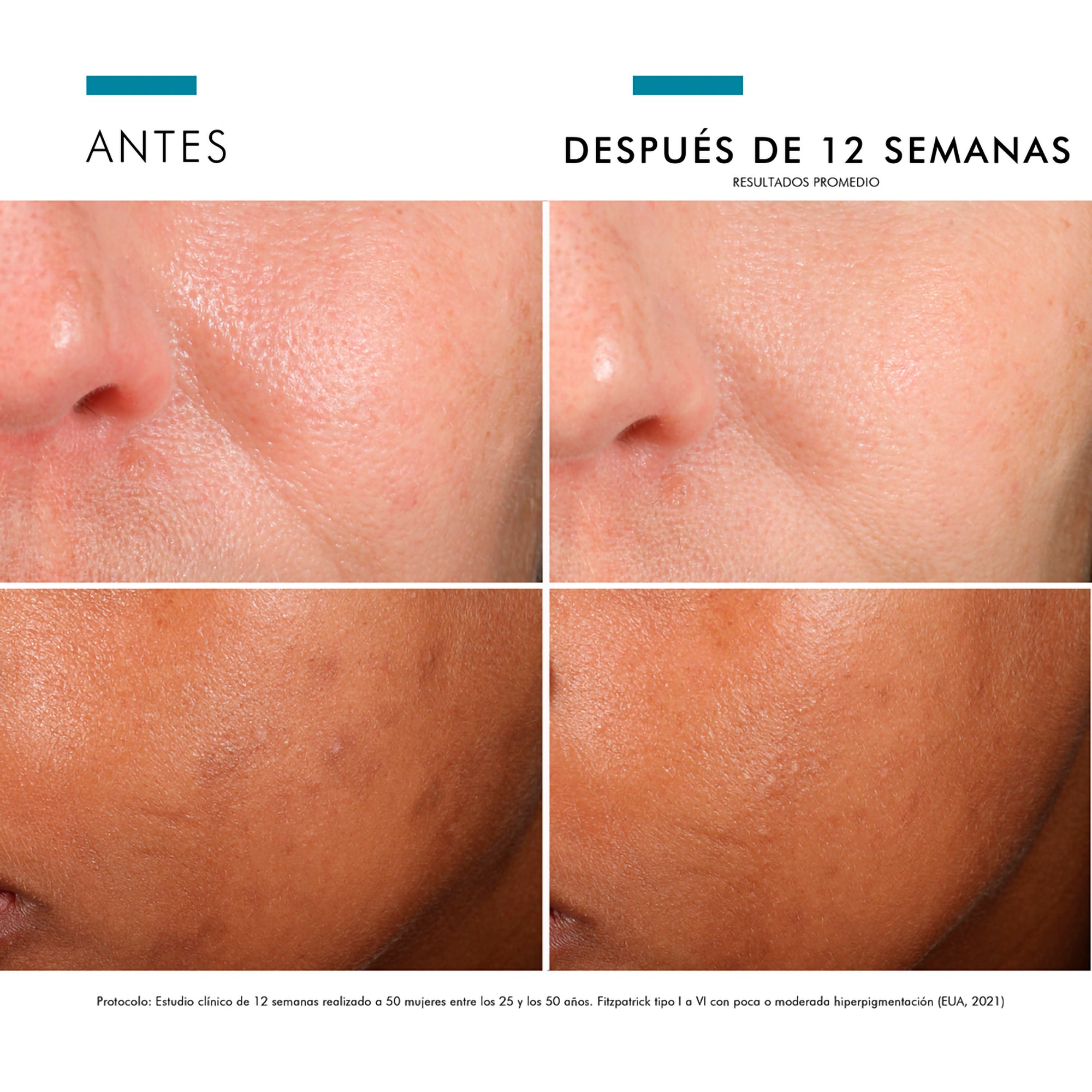 Skinceuticals Serum Antioxidante Anti Manchas Phloretin CF