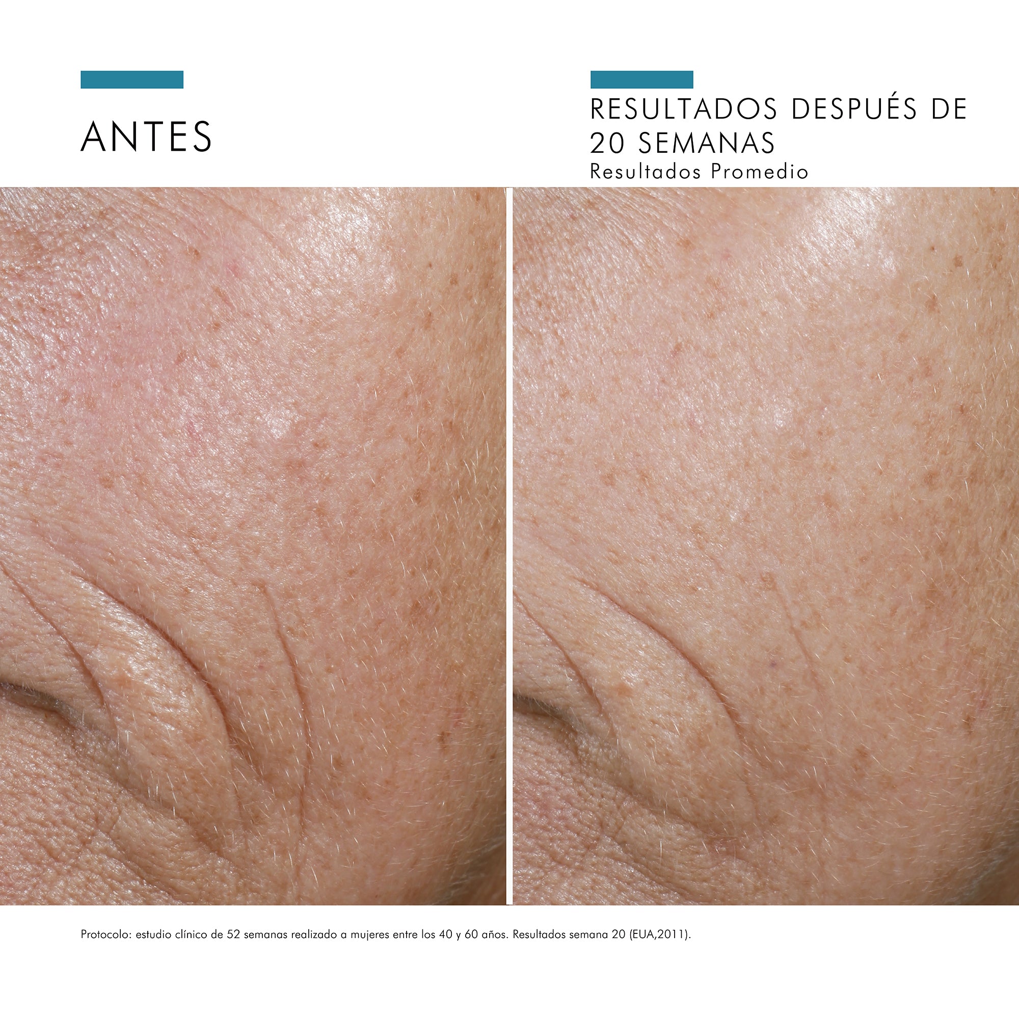 Skinceuticals Sérum Antioxidante CE Ferulic