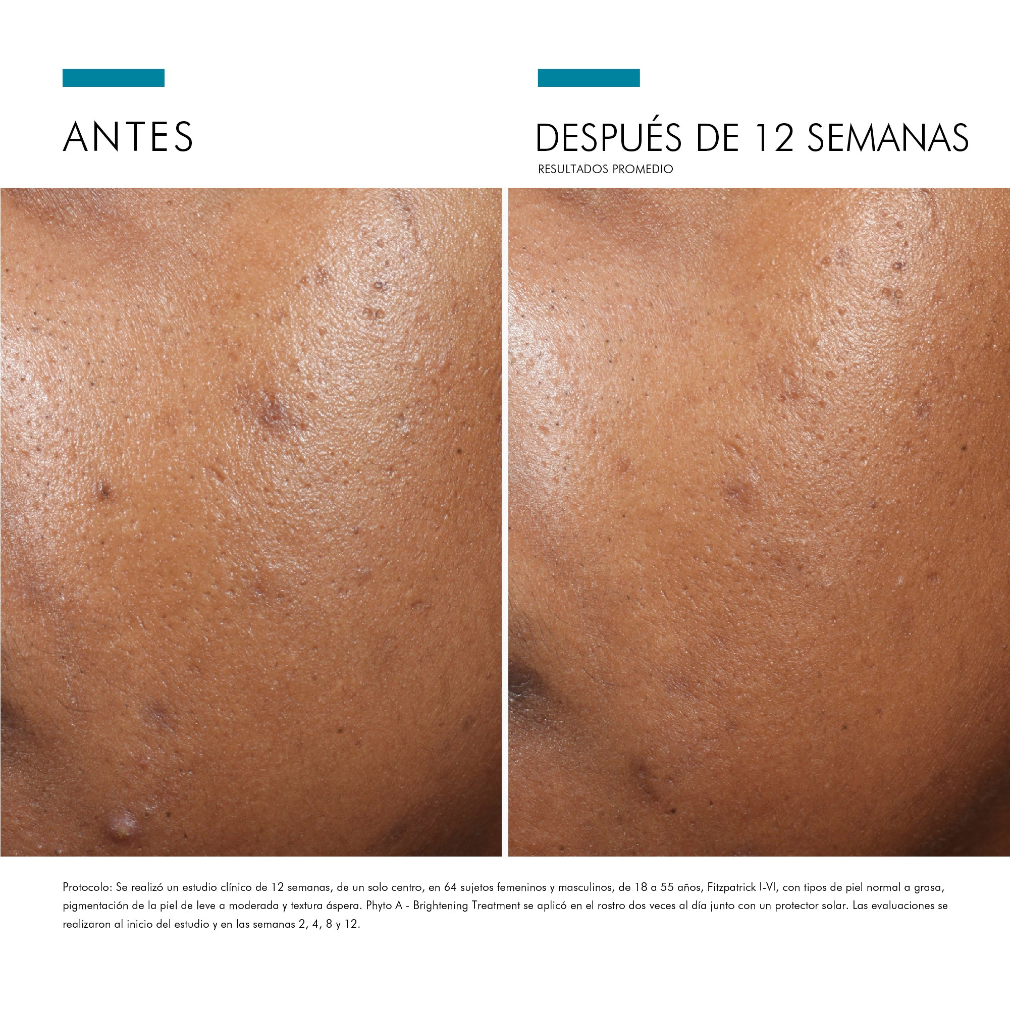 Skinceuticals Hidratante Corrector Phyto A+ Brightening Treatment
