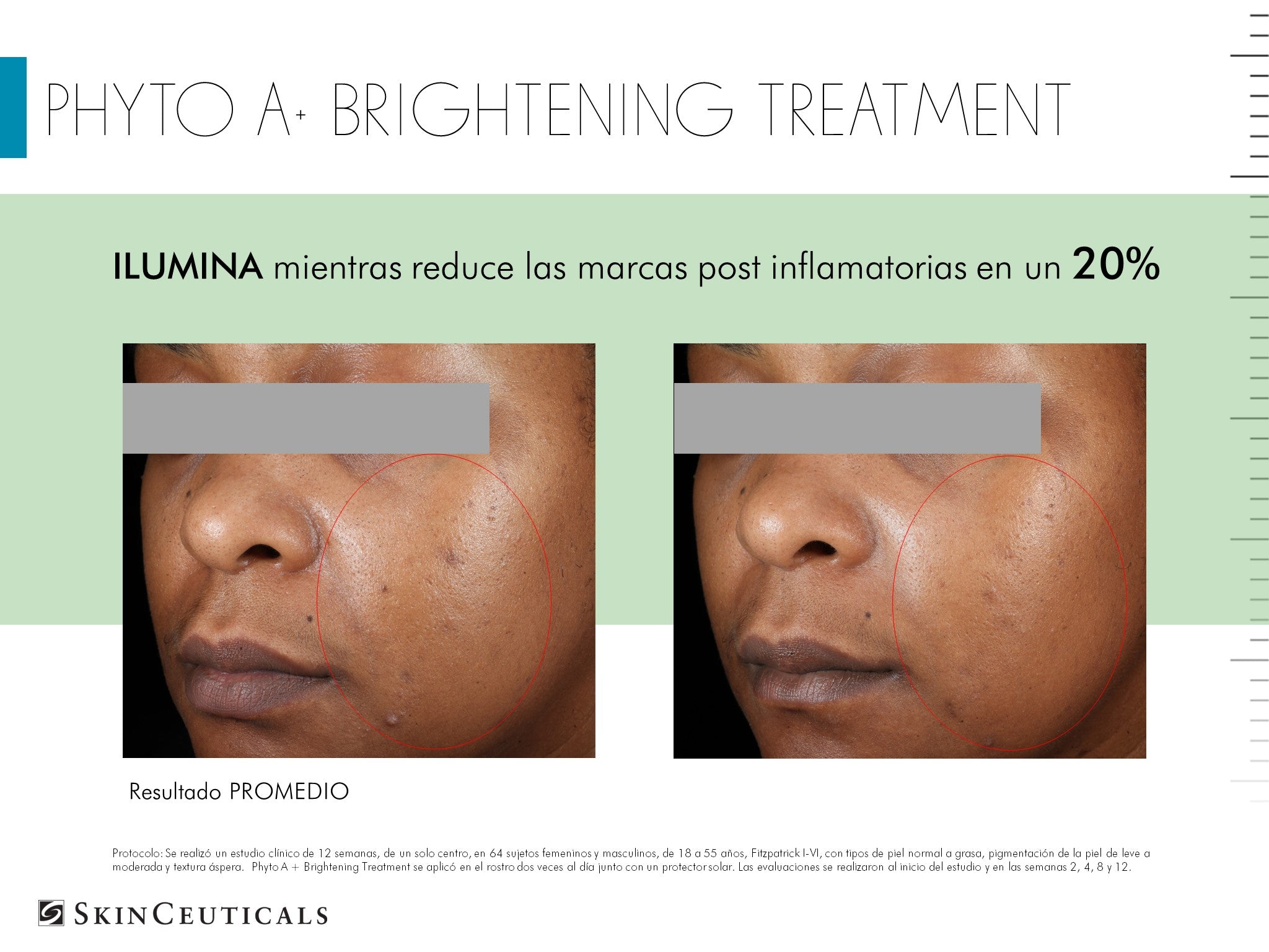 Skinceuticals Hidratante Corrector Phyto A+ Brightening Treatment
