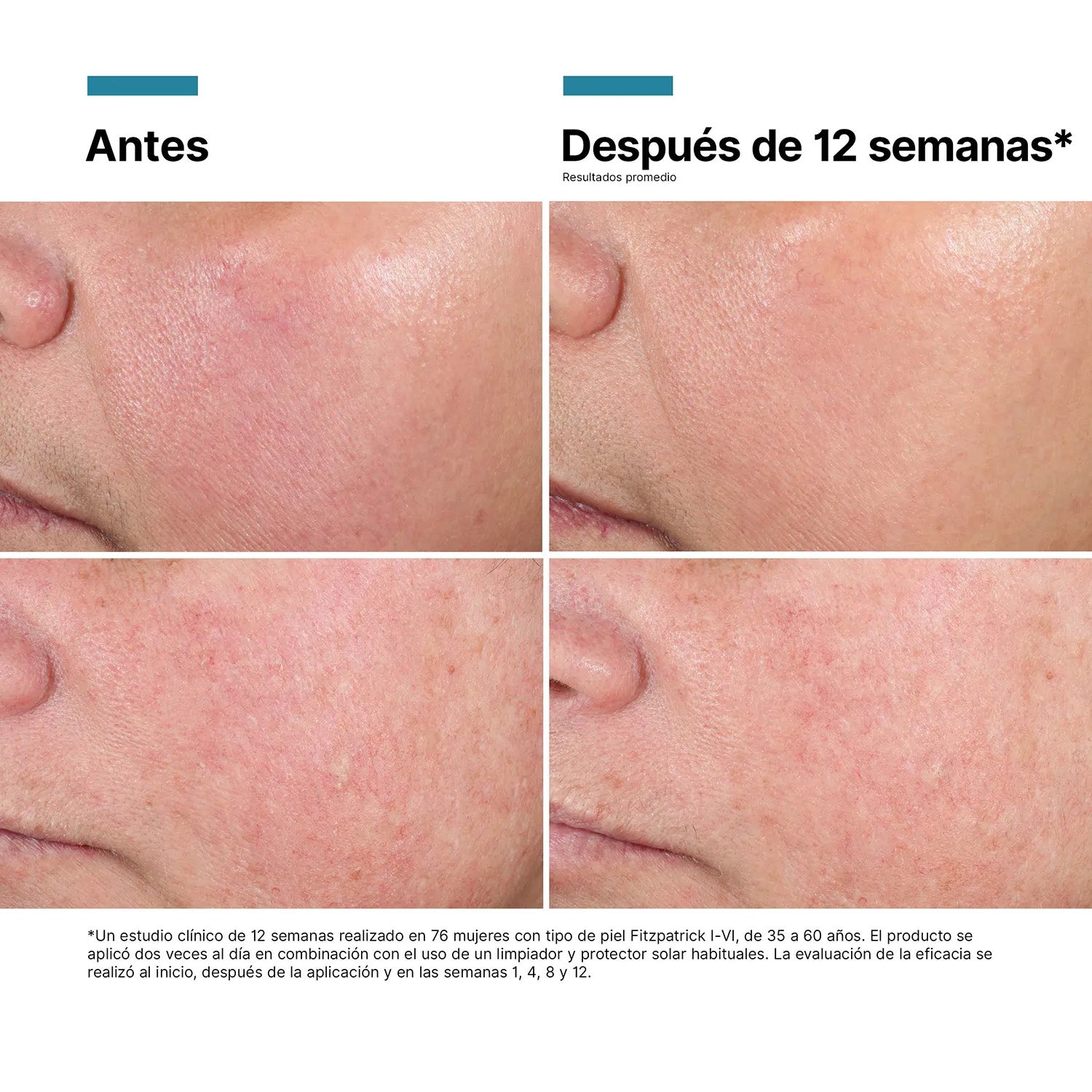 Skinceuticals Advanced RGN-6 Crema Regeneradora