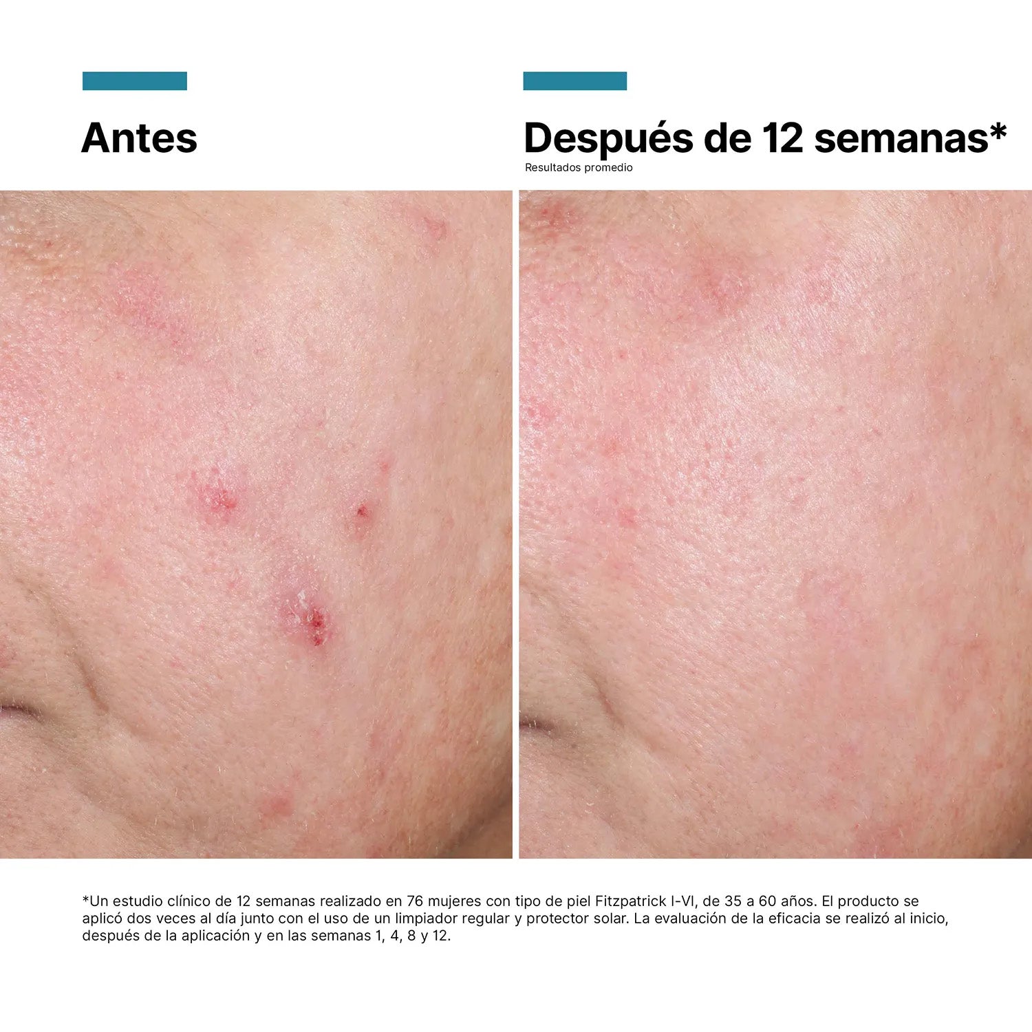 Skinceuticals Advanced RGN-6 Crema Regeneradora