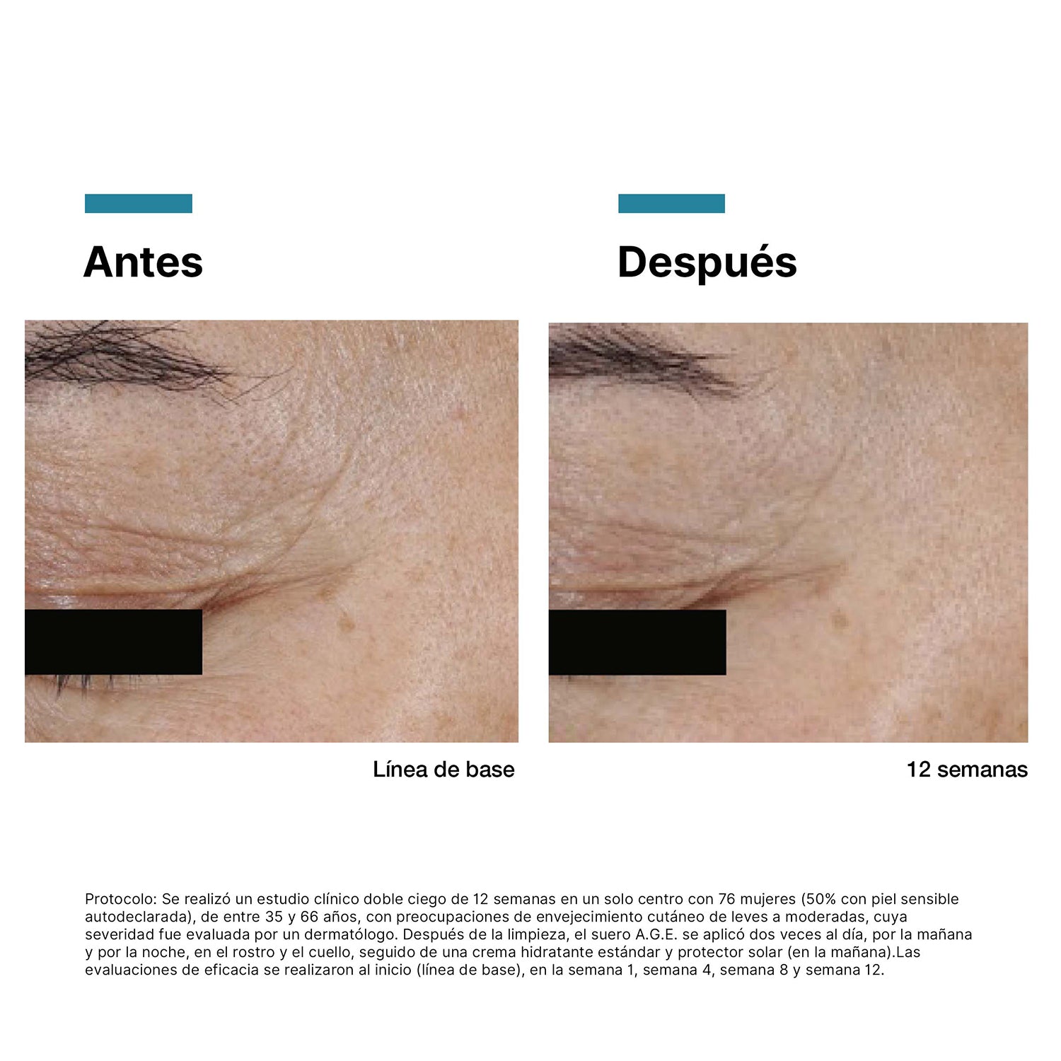 Skinceuticals A.G.E. Interrupter Ultra Serum Antiedad Efecto Lifting