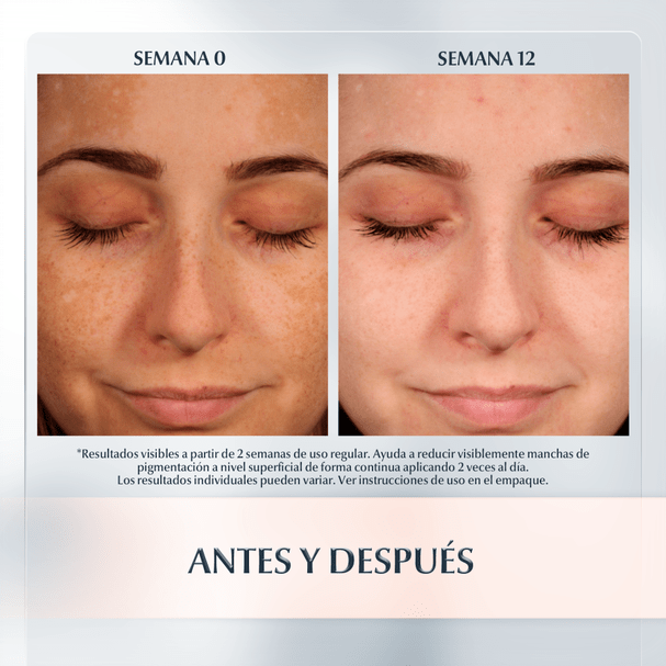 Eucerin - Anti Pigment Dual Serum