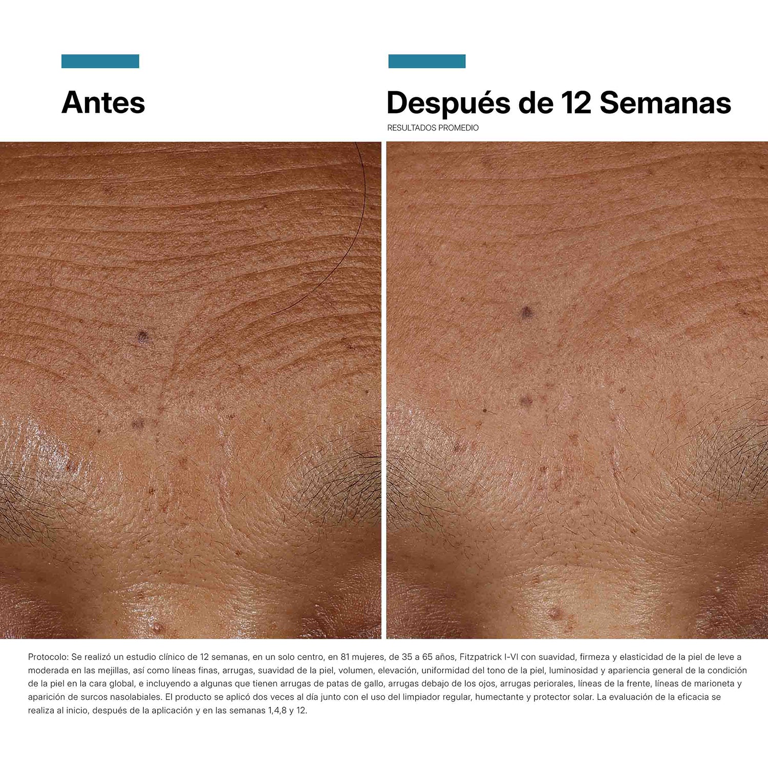 Skinceuticals Sérum Ácido Hialurónico HA Intensifier Multi-Glycan